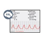 CapnoScan® - End-Tidal CO2 Monitor module for PhysioSuite system