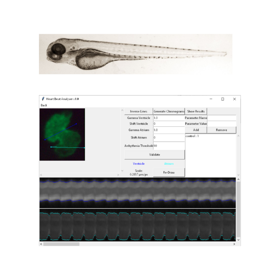 zebrafish-ejection-fraction-qt-interval-and-beat-defects.png