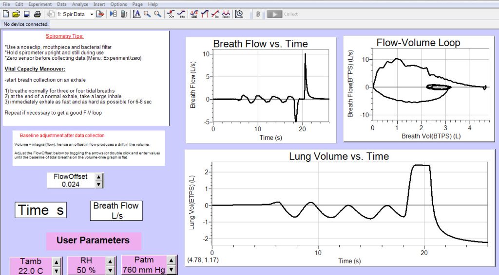 Spirometry-data-2-1024x566.jpg